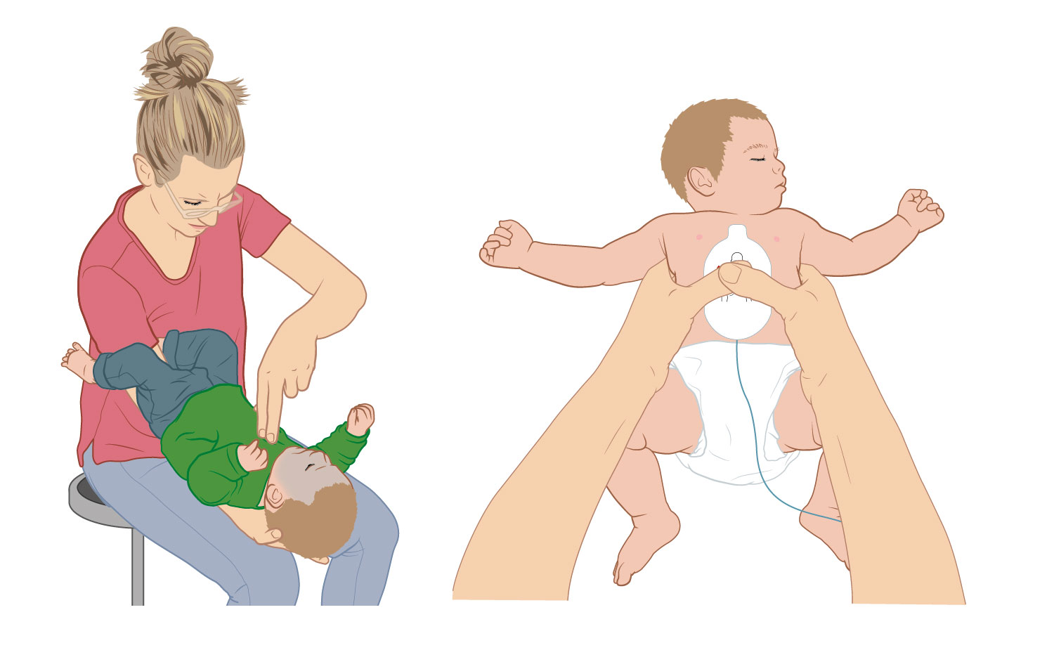reanimatie-baby